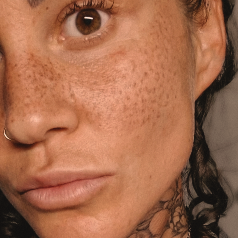 Man sieht eine Nahaufnahme von einem Frauengesicht von Sommersprossen Tattoos.